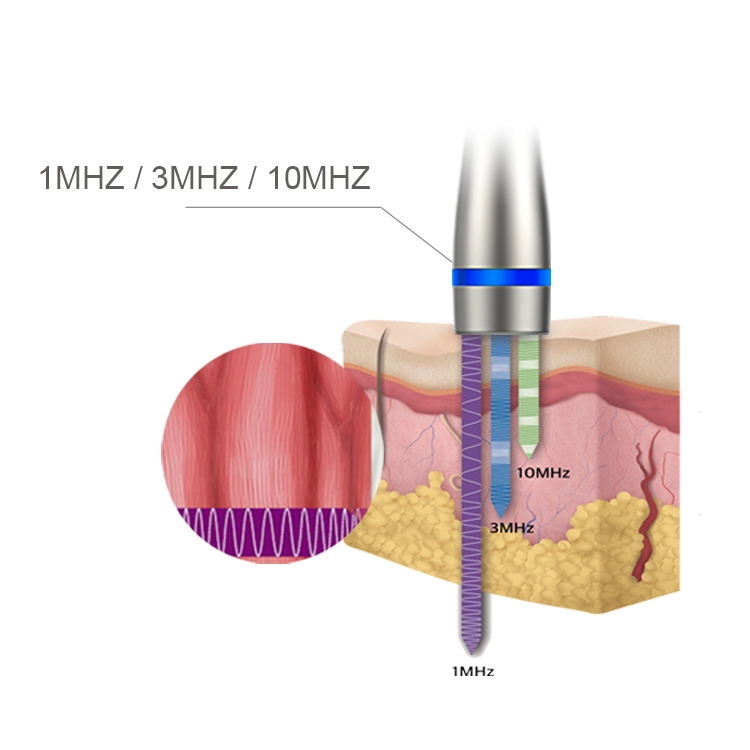 LDM Noblesse 10 MHz Ultrassom Terapia 3 em 1 Ultrassônico Remoção de Rugas Dispositivo de Emagrecimento de Beleza Instrumento de Cuidados Faciais
